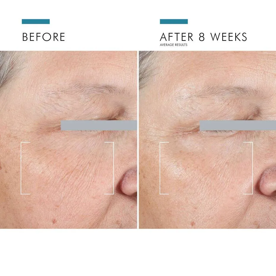 Skinceuticals AGE Advanced Eye - NEW
